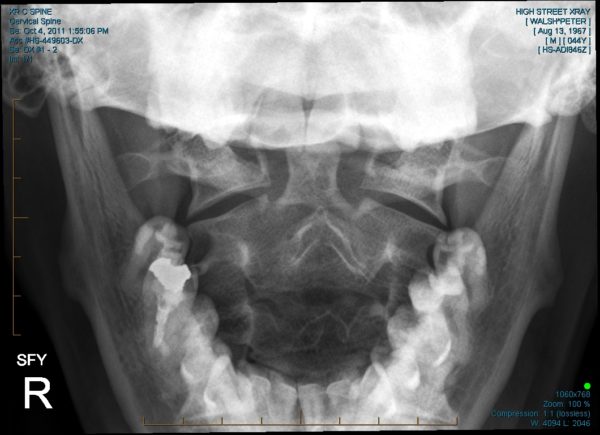 Read more about the article Pain in the…